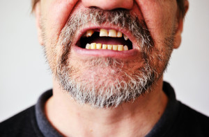 Man's Face With An Open Toothless Mouth